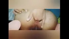 Luna edi mastoquedoce deliği