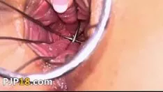 彼女の婦人科の子猫のギャップは本当に深刻です